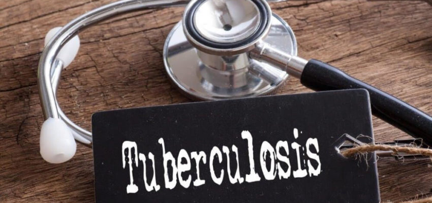 Tuberkuloz