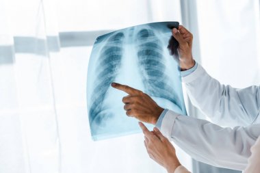 Туберкульоз: маршрут пацієнта